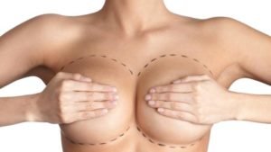 breast-enlargement-7